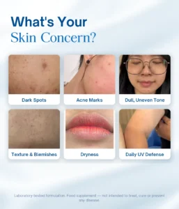 What is your skin concern — dark spots, acne marks, dull uneven tone, texture, dryness, UV defense