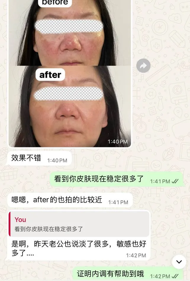 Message a Lipo Crystal customer sent to the brand