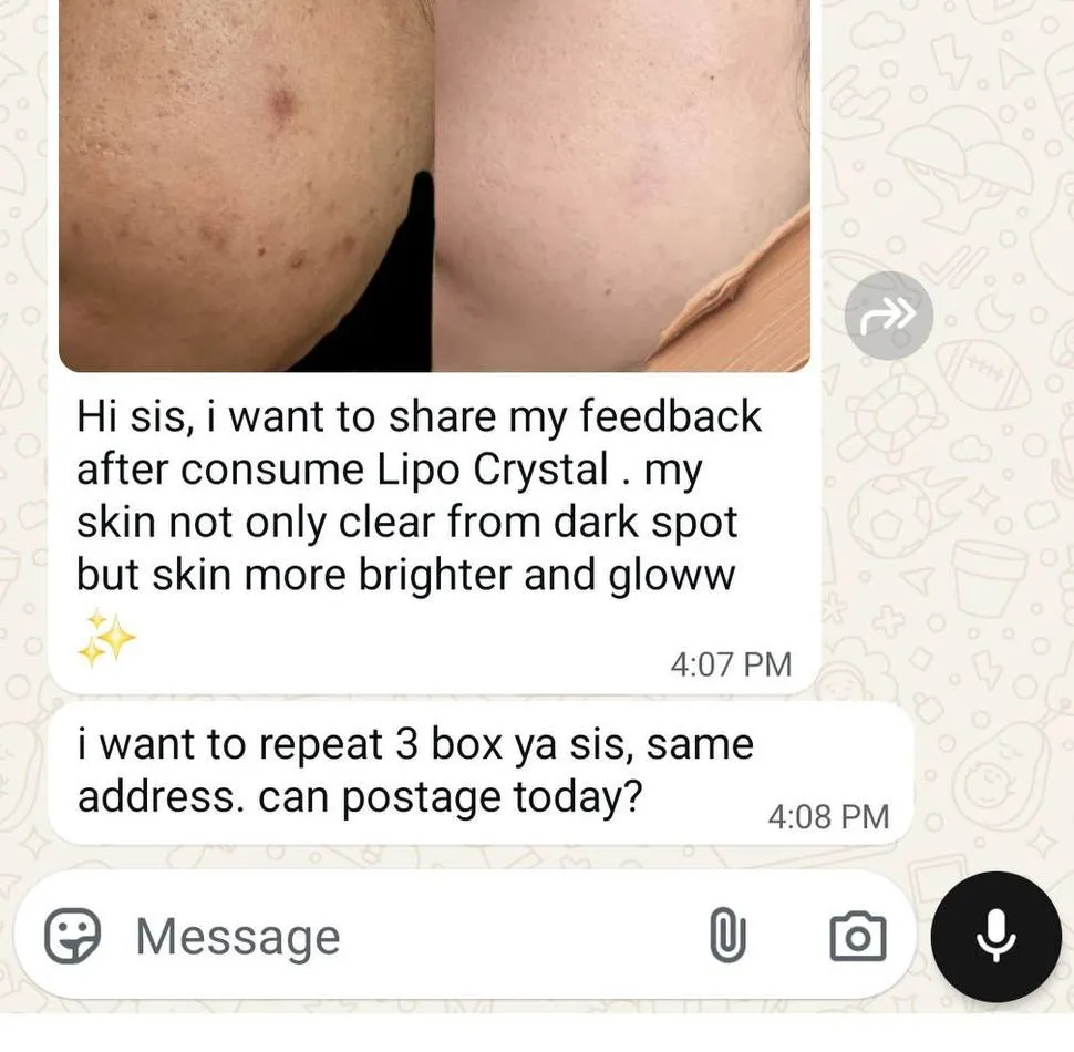 Message a Lipo Crystal customer sent to the brand