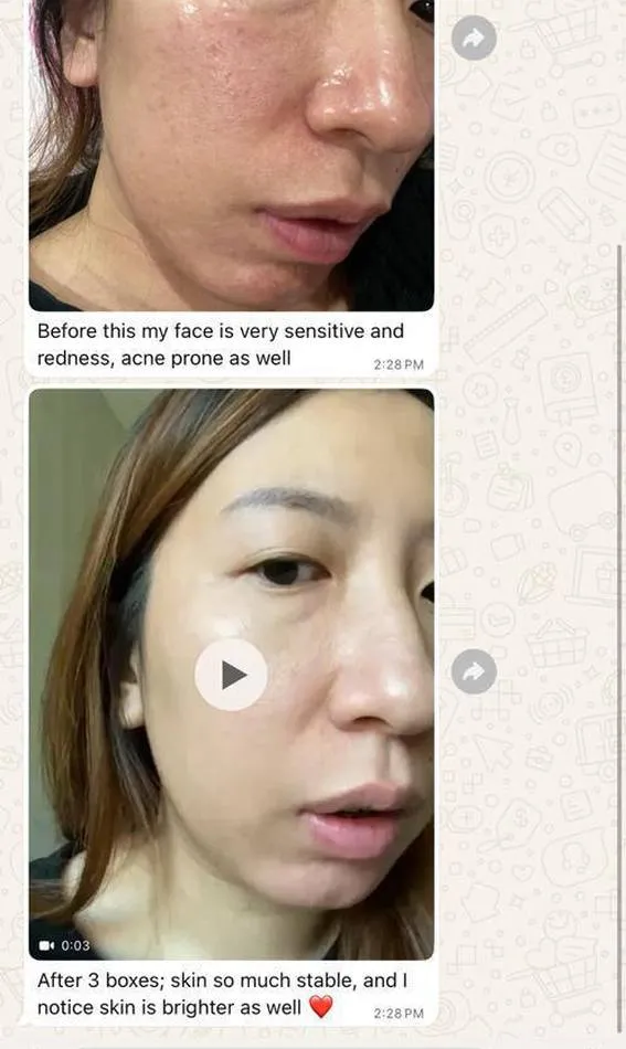 Message a Lipo Crystal customer sent to the brand