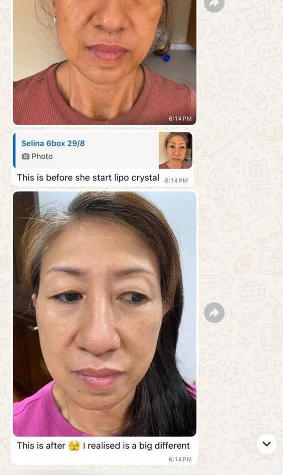 Message a Lipo Crystal customer sent to the brand