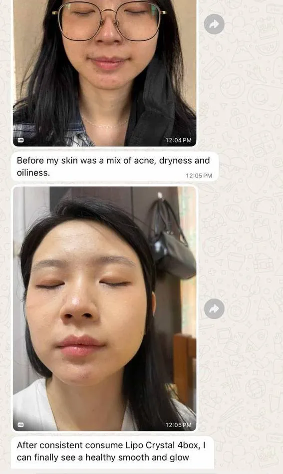 Message a Lipo Crystal customer sent to the brand