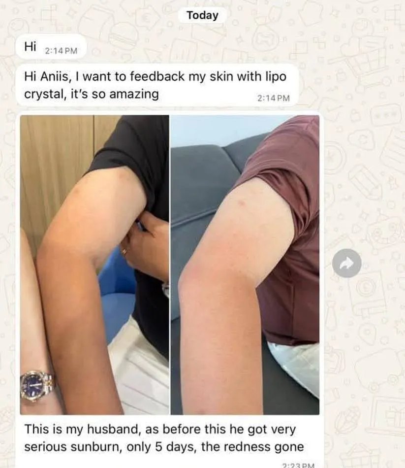 Message a Lipo Crystal customer sent to the brand